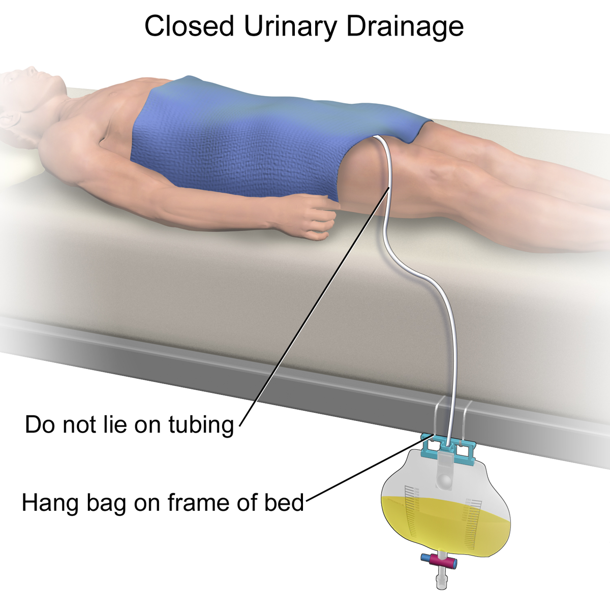 File Closed Urinary Drainage.png Wikipedia