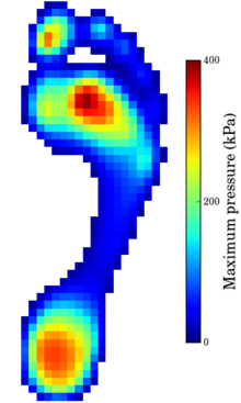 Example foot pressure Example foot pressure.png