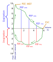 Fluss-Volumen-Diagramm