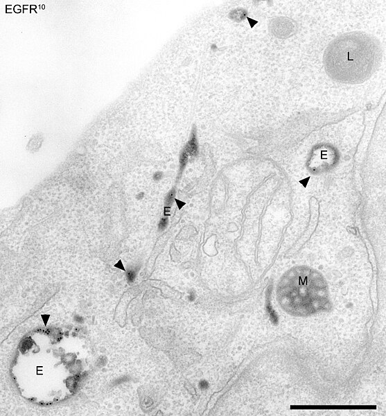 Electron micrograph of endosomes in human HeLa cells. Early endosomes (E - labeled for EGFR, 5 minutes after internalisation, and transferrin), late e