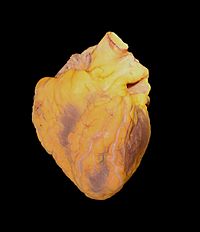 Human heart from an autopsy
