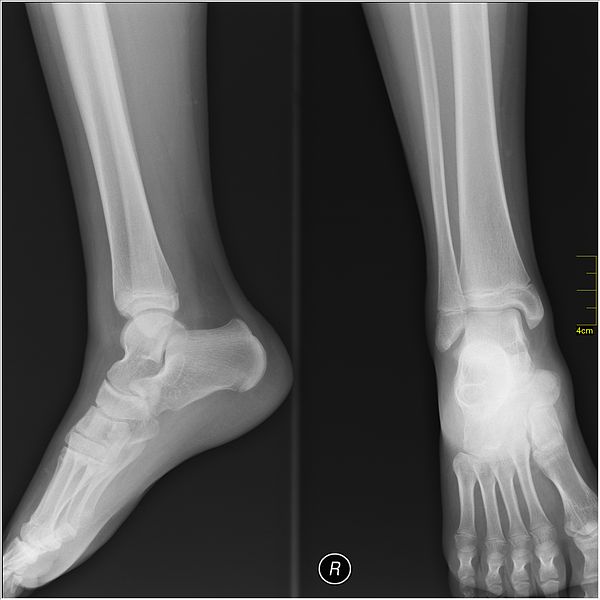 File:Medical X-Ray imaging MBC05 nevit.jpg