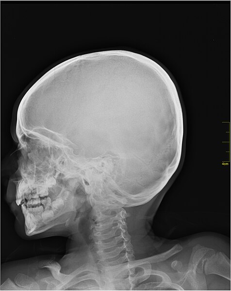 File:Medical X-Ray imaging TAN07 nevit.jpg