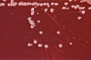 Kolonien von Pseudomonas aeruginosa in einem Blutagar