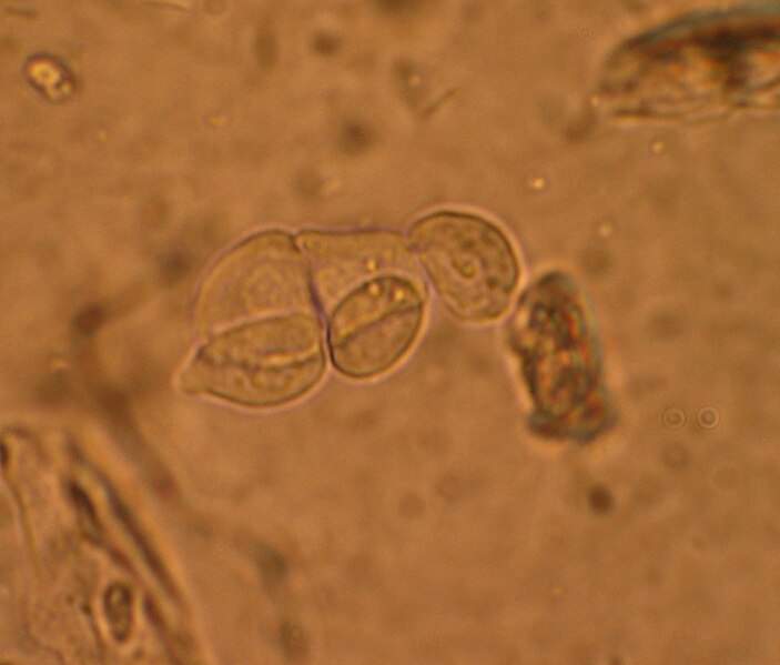 File:RTcells.JPG