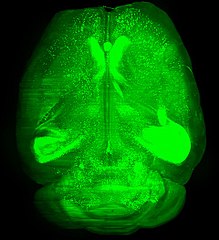 A mouse brain (Thy-1 GFP-M) cleared using 3DISCO method and imaged by light-sheet microscopy.