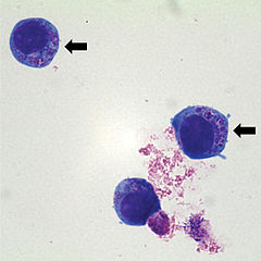 Anaplasma phagocytophilum cultured in human promyelocytic cell line HL-60.jpg