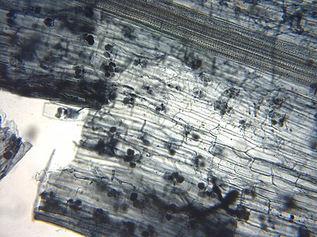 Tập tin:Arbuscular mycorrhiza microscope.jpg