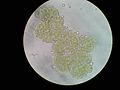 Botryococcus terribilis.jpg