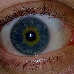 Почему глаза желтоватого. Центральная гетерохромия голубых глаз. Центральная гетерохромия карих глаз. Центральная гетерохромия хамелеон. Гетерохромия Радужки глаз.