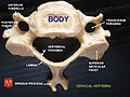 Cervical vertebra.jpg