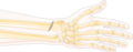 Forearm fracture - Radius fracture