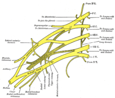 Odstup n. axillaris z plexus brachialis