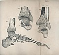 Imprints from skeletal foot (8616851548).jpg