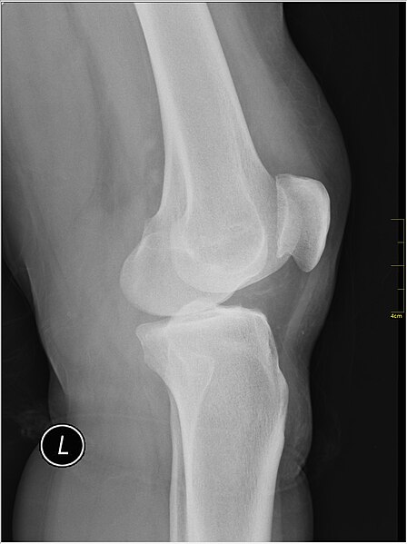 File:Medical X-Ray imaging EAW04 nevit.jpg