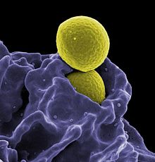 Neutrophil ingesting Methicillin-resistant Staphylococcus aureus (MRSA). Methicillin-resistant Staphylococcus aureus (MRSA) Ingestion by a Neutrophil (6830921049).jpg