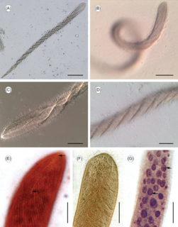 <i>Cepedea</i> Genus of single-celled organisms