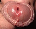 Penis hole.jpg
