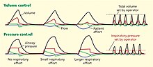 Thumbnail for Dual-control modes of ventilation