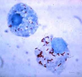 Клітини кліщів, заражені Rickettsia rickettsii, фарбування за Гіменесом