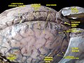 腦膜和淺表腦靜脈深層解剖。