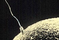 A sperm fertilizing an egg in sexual reproduction is one stage of reproductive success Sperm-egg.jpg