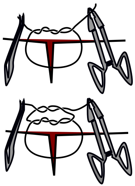 File:Surgical suture knot001.svg