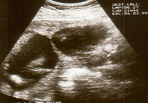 Ultrasound Scan ND 008.jpg