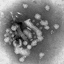 Virions of enteroviruses in Rigvir.jpg