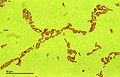 Escherichia coli (259 02) Gramnegative rods.jpg