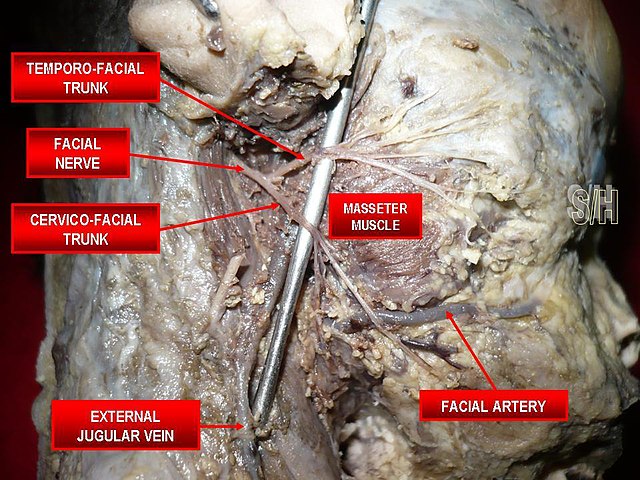 File:Mandibular nerve.jpg - Wikipedia