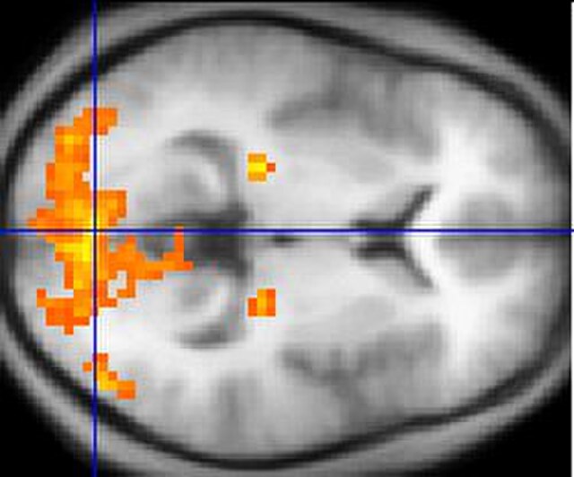 Since the 1980s, sophisticated neuroimaging procedures, such as fMRI (above), have furnished increasing knowledge about the workings of the human brai