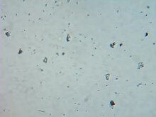 চিত্র:Human sperm under microscope.webm