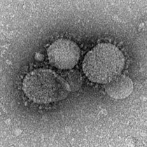 Electron micrograph of MERS-CoV.