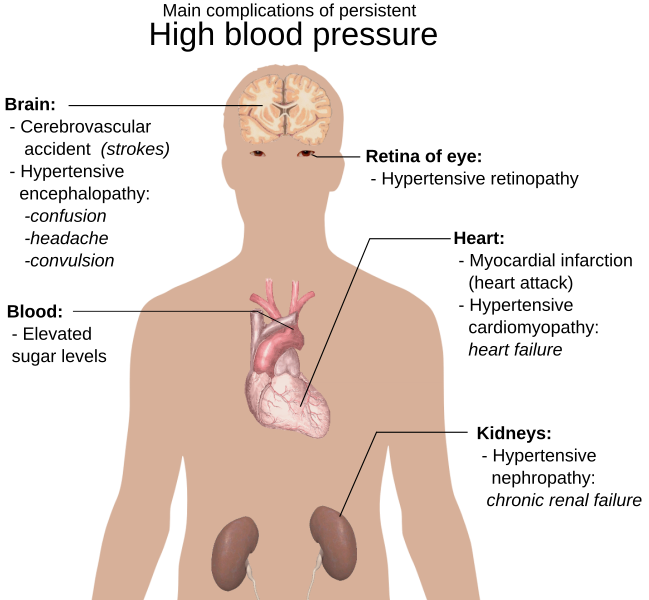 File:Main complications of persistent high blood pressure.svg