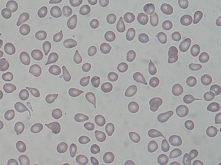 <span class="mw-page-title-main">Dacrocyte</span> Abnormal shape of red blood cell