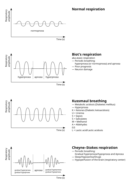 Tập_tin:Breathing_abnormalities.svg