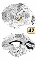 ブロードマンの脳地図における42野。聴覚野にあたる。