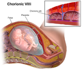 Thumbnail for Chorionic villi