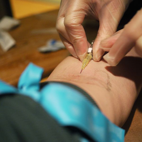 File:Extraction of blood needle catheter.jpg