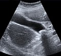 Medical Ultrasound