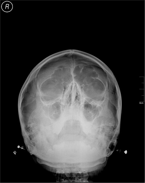 File:Medical X-Ray imaging AJU02 nevit.jpg