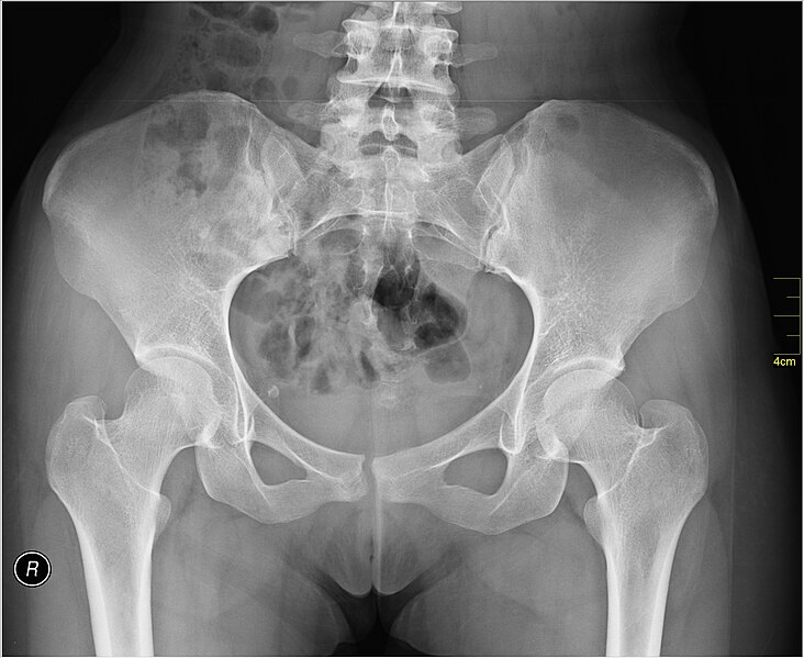 File:Medical X-Ray imaging WVX07 nevit.jpg