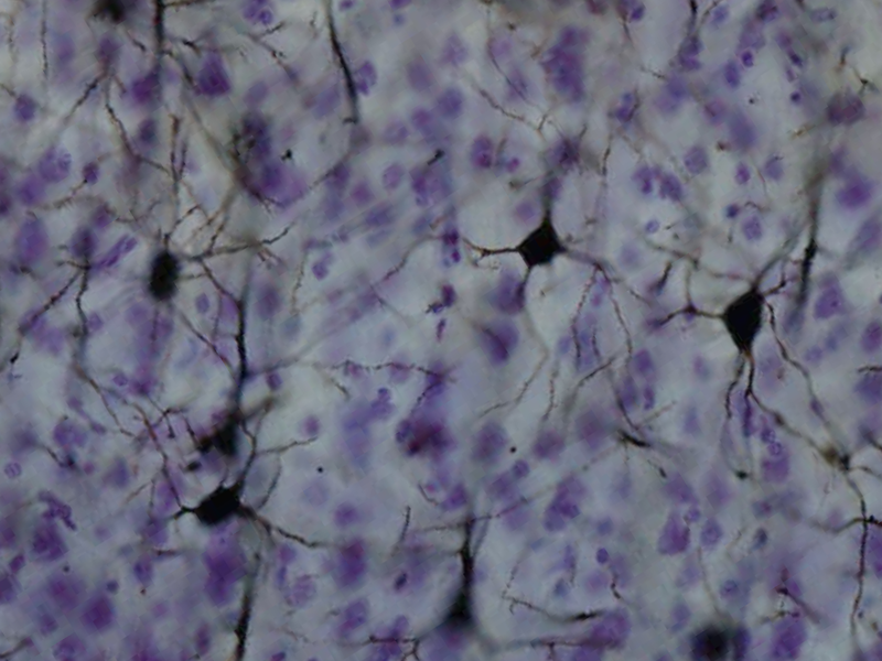 Fasciculus:NeuronGolgi.png