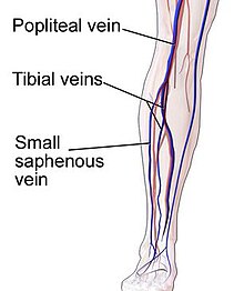 The poplitial vein can be one site of venous stasis in the lower leg. Obstruction of this vein during travel contributes to statis. Poplitial vein.jpg