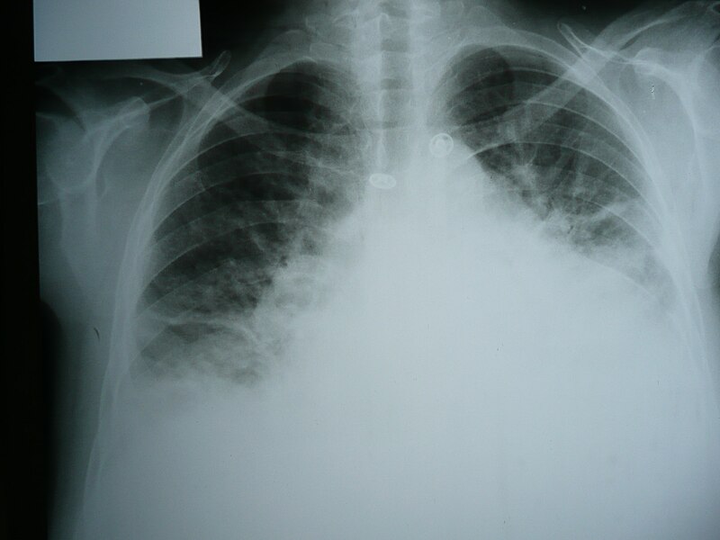 File:Radiology 1300577 Nevit.jpg