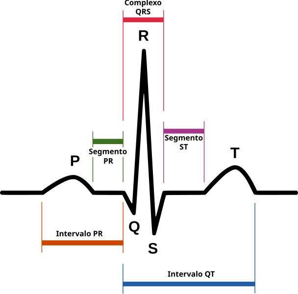 File:SinusRhythmLabels-gl.svg