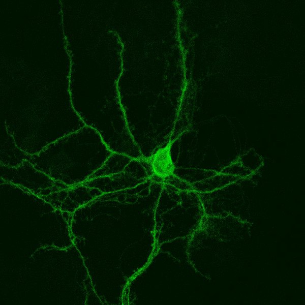 File:Striatal Medium-Sized Spiny Neuron.jpg