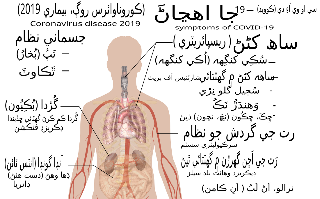 File:Symptoms of coronavirus disease 2019-sd.svg