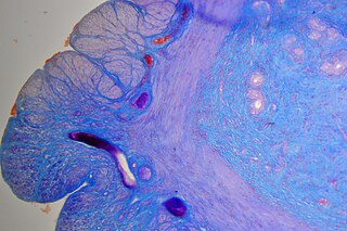 <span class="mw-page-title-main">Mallory's trichrome stain</span>